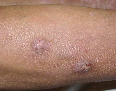 Dermatopathology | Nuffield Health