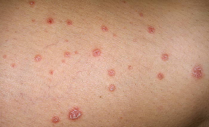 Dermatology - Medscape