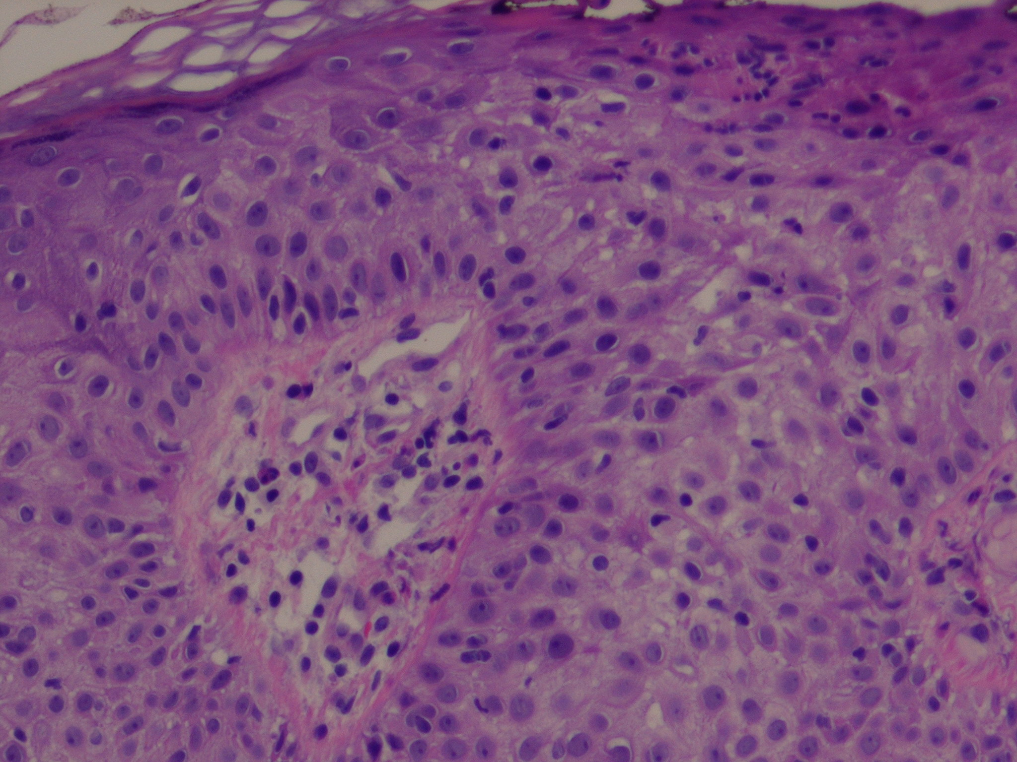 Dermoscopy of other non-melanocytic lesions - DermNet NZ